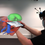 Exploring and Slicing Volumetric Medical Data in Augmented Reality Using a Spatially-Aware Mobile Device
